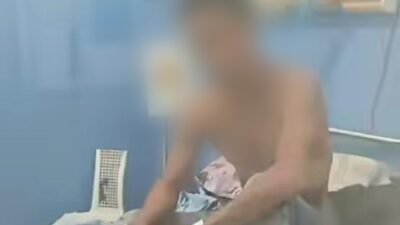 Positif Rabies, Pria di Manggarai Timur Tewas Usai Digigit Anjing Peliharaan Sendiri